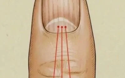 Vertical Nail Ridges: 6 Nutrients That Support Stronger, Healthier Nails